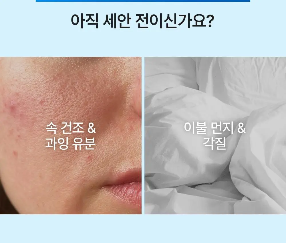 [스킨케어링 80% 클렌저]유이크 바이옴 레미디 올인원 앰플 클렌저 200ml 상세페이지 4